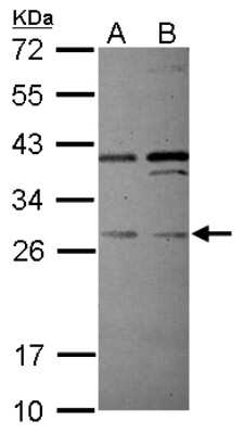 Western Blot: PLEKHF2 Antibody [NBP2-19865]