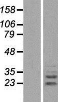 Western Blot: PLEKHF2 Overexpression Lysate [NBP2-06314]