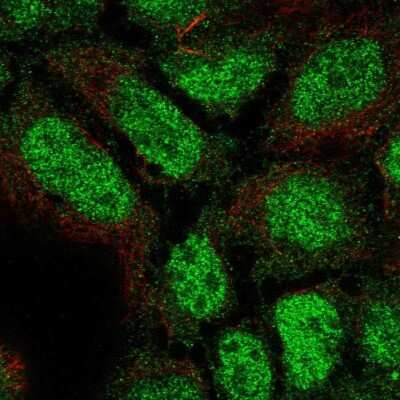 Immunocytochemistry/ Immunofluorescence: PLEKHG1 Antibody [NBP2-55517]