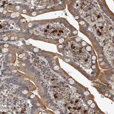 Immunohistochemistry-Paraffin: PLEKHG1 Antibody [NBP1-90845]