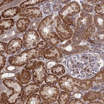 Immunohistochemistry-Paraffin: PLEKHG2 Antibody [NBP2-13772]