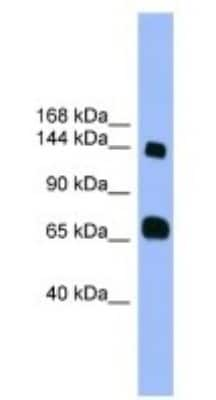 Western Blot: PLEKHG2 Antibody [NBP1-69100]