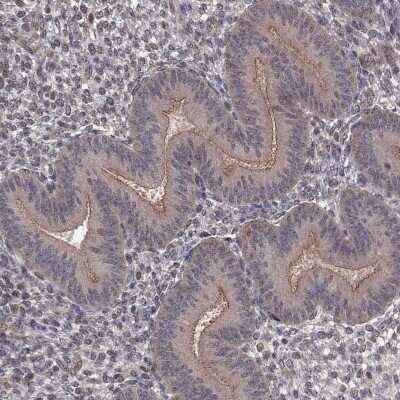 Immunohistochemistry: PLEKHG3 Antibody [NBP2-68967]