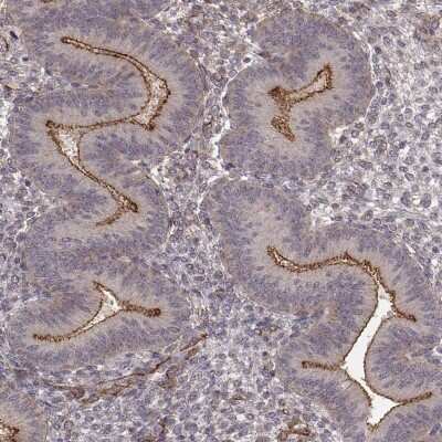 Immunohistochemistry: PLEKHG3 Antibody [NBP2-68986]