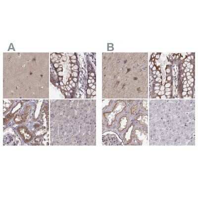 Immunohistochemistry-Paraffin: PLEKHG3 Antibody [NBP2-68967]
