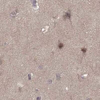 Immunohistochemistry-Paraffin: PLEKHG3 Antibody [NBP2-68967]