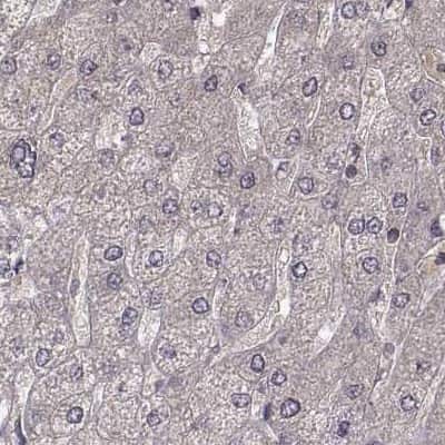 Immunohistochemistry-Paraffin: PLEKHG3 Antibody [NBP2-68967]