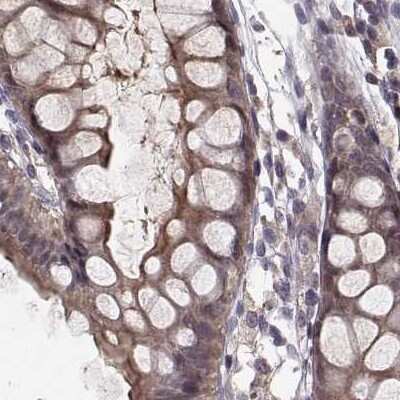 Immunohistochemistry-Paraffin: PLEKHG3 Antibody [NBP2-68967]