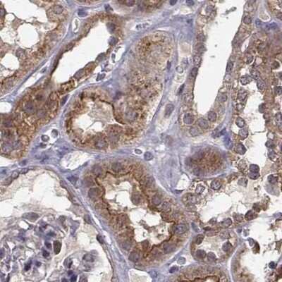 Immunohistochemistry-Paraffin: PLEKHG3 Antibody [NBP2-68967]