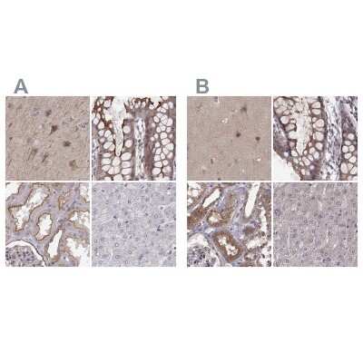 Immunohistochemistry-Paraffin: PLEKHG3 Antibody [NBP2-68986]