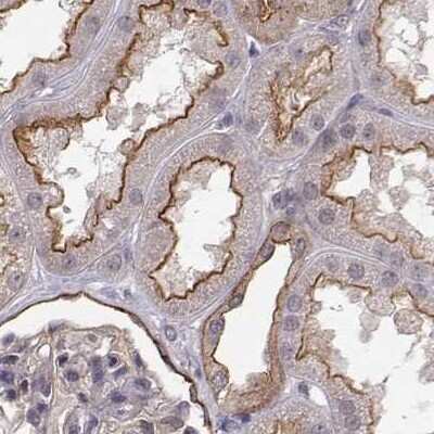 Immunohistochemistry-Paraffin: PLEKHG3 Antibody [NBP2-68986]