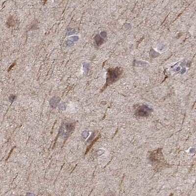Immunohistochemistry-Paraffin: PLEKHG3 Antibody [NBP2-68986]