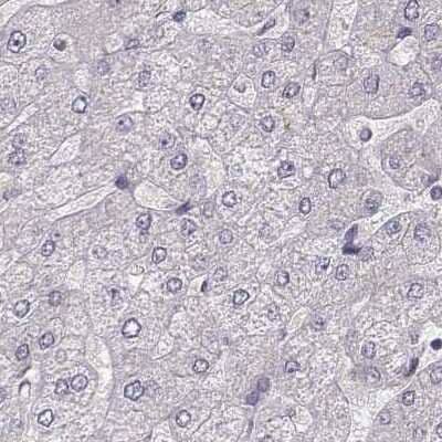 Immunohistochemistry-Paraffin: PLEKHG3 Antibody [NBP2-68986]