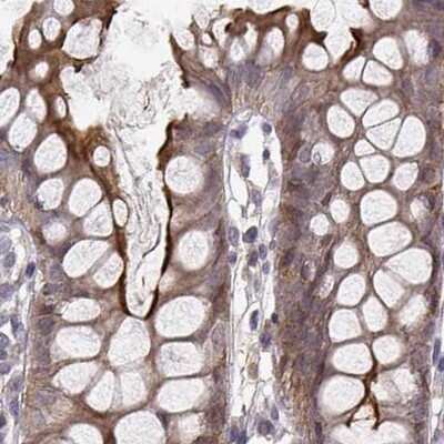 Immunohistochemistry-Paraffin: PLEKHG3 Antibody [NBP2-68986]