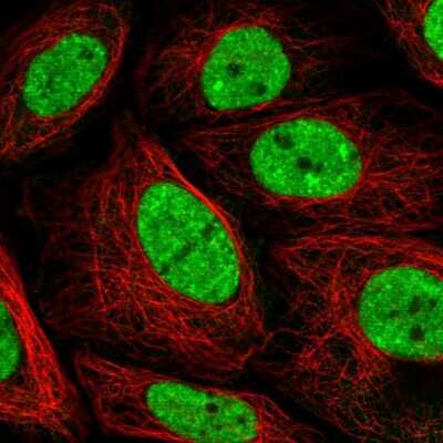 Immunocytochemistry/ Immunofluorescence: PLEKHG4B Antibody [NBP2-58811]