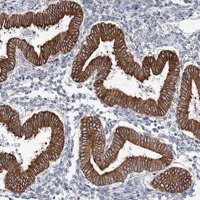 Immunohistochemistry-Paraffin: PLEKHG4B Antibody [NBP1-93566]