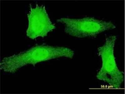 Immunocytochemistry/ Immunofluorescence: PLEKHG5 Antibody (5A9) [H00057449-M01]