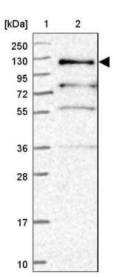 Western Blot: PLEKHG5 Antibody [NBP2-13774]