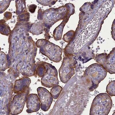 Immunohistochemistry-Paraffin: PLEKHG6 Antibody [NBP1-83840]