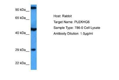 Western Blot: PLEKHG6 Antibody [NBP2-85493]