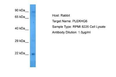 Western Blot: PLEKHG6 Antibody [NBP2-85494]