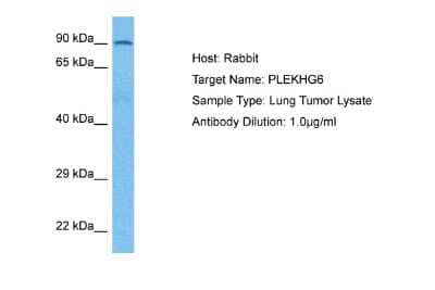 Western Blot: PLEKHG6 Antibody [NBP2-85496]