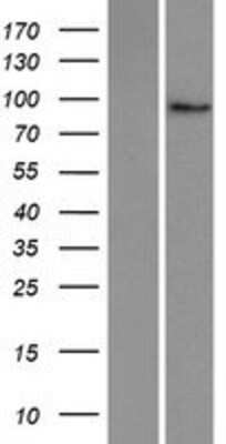 Western Blot: PLEKHG6 Overexpression Lysate [NBP2-06864]