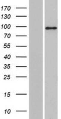 Western Blot: PLEKHG6 Overexpression Lysate [NBP2-09709]