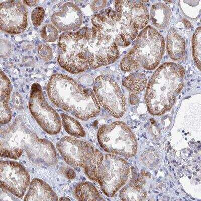 Immunohistochemistry-Paraffin: PLEKHG7 Antibody [NBP2-32558]