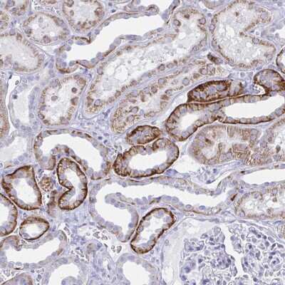 Immunohistochemistry: PLEKHH1 Antibody [NBP2-49027]