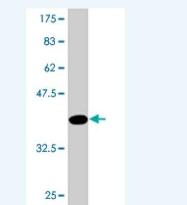 Western Blot: PLEKHH3 Antibody (4F8) [H00079990-M03]