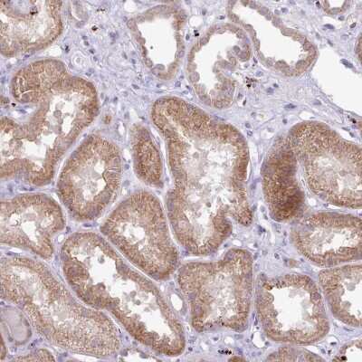 Immunohistochemistry: PLEKHH3 Antibody [NBP2-47330]