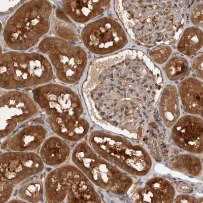 Immunohistochemistry-Paraffin: PLEKHM1 Antibody [NBP1-83013]