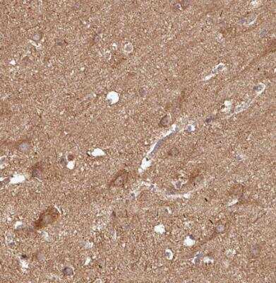 Immunohistochemistry-Paraffin: PLEKHM1 Antibody [NBP2-38449]