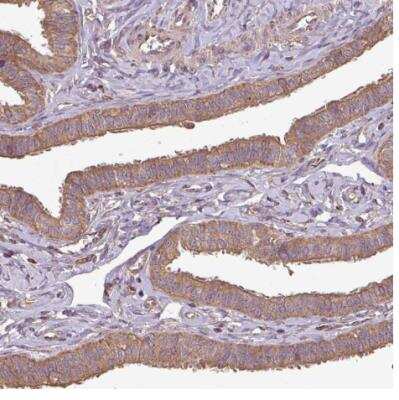 Immunohistochemistry-Paraffin: PLEKHM1 Antibody [NBP2-38449]