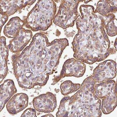 Immunohistochemistry-Paraffin: PLEKHM1 Antibody [NBP2-38449]