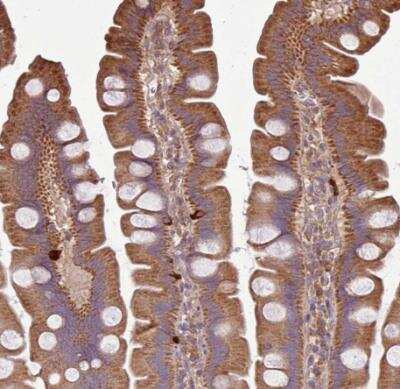 Immunohistochemistry-Paraffin: PLEKHM1 Antibody [NBP2-38449]