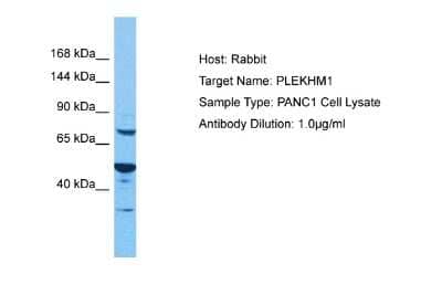 Western Blot: PLEKHM1 Antibody [NBP2-88068]