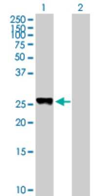 Western Blot: PLEKHM1P Antibody [H00440456-B01P]