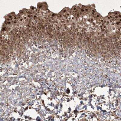 Immunohistochemistry-Paraffin: PLEKHM2 Antibody [NBP1-81472]