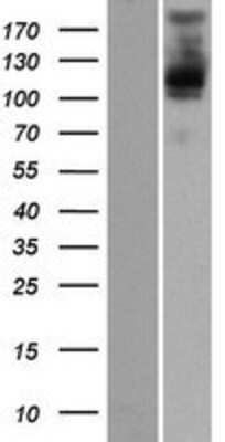 Western Blot: PLEKHM2 Overexpression Lysate [NBP2-07208]