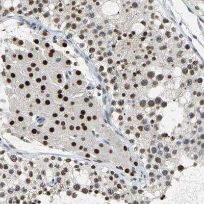 Immunohistochemistry-Paraffin: CCDC88C Antibody [NBP1-90600]