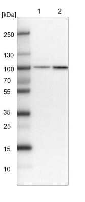 Western Blot: PLEKHM3 Antibody [NBP1-94090]