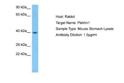 Western Blot: PLEKHN1 Antibody [NBP2-83401]