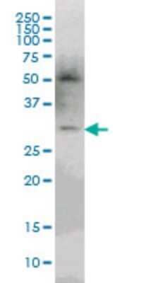 Western Blot: PLEKHO2 Antibody (3D9) [H00080301-M03]