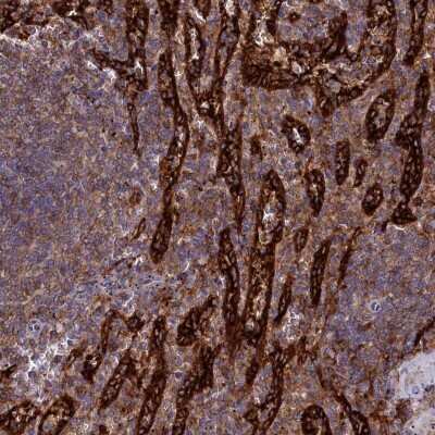 Immunohistochemistry-Paraffin: PLEKHO2 Antibody [NBP1-84101]