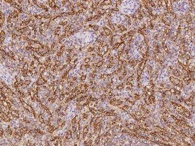 Immunohistochemistry-Paraffin: PLEKHO2 Antibody [NBP3-06325]