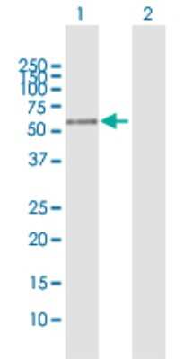 Western Blot: PLEKHO2 Antibody [H00080301-B01P]