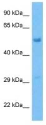 Western Blot: PLEKHO2 Antibody [NBP3-10197]