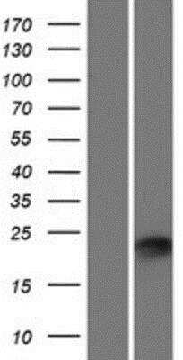 Western Blot: PLET-1 Overexpression Lysate [NBP2-09723]